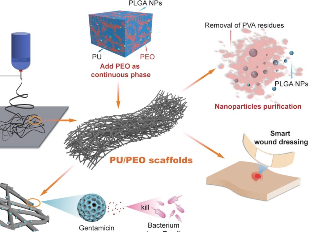 A flow chart demonstrating nanoparticles working to purify bacterium in wound dressing