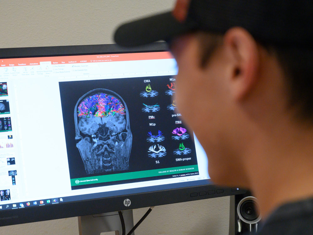 A brain scan on a computer screen