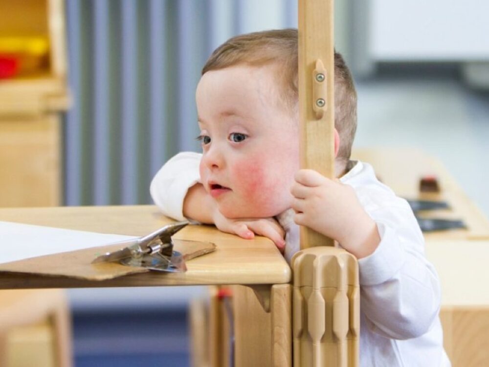 A child with down syndrome leans his chin on a table